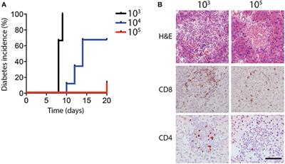 NK Cells Regulate CD8+ T Cell Mediated Autoimmunity